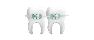 dientes con brakets convencionales