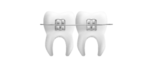 dientes con brakets de autoligado