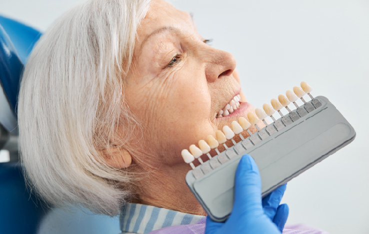 mujer de edad lista para recibir implante dental