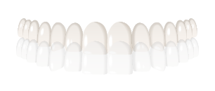 dientes con ortodoncia invisible