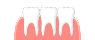 ilustracion sobre la periodoncia