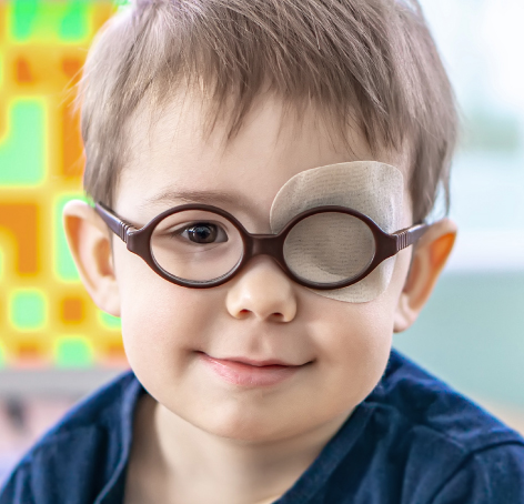 nino con parche en su ojo luego de tratamiento de terapia ortoptica