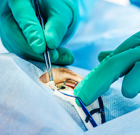 manos de cirujano realizando cirugia de retina