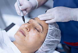 mujer recibiendo oculoplastia