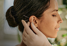 mujer recibiendo acupuntura en su oreja