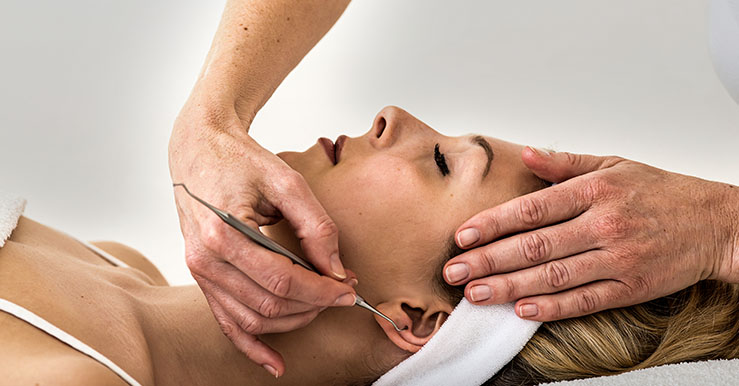 mujer recibiendo servicio de auriculoterapia