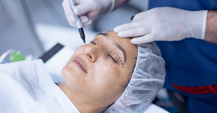 mujer recibiendo el servicio de oculoplastia
