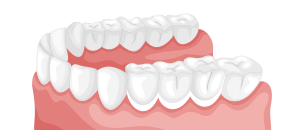 ilustracion de dientes inferiores de una persona